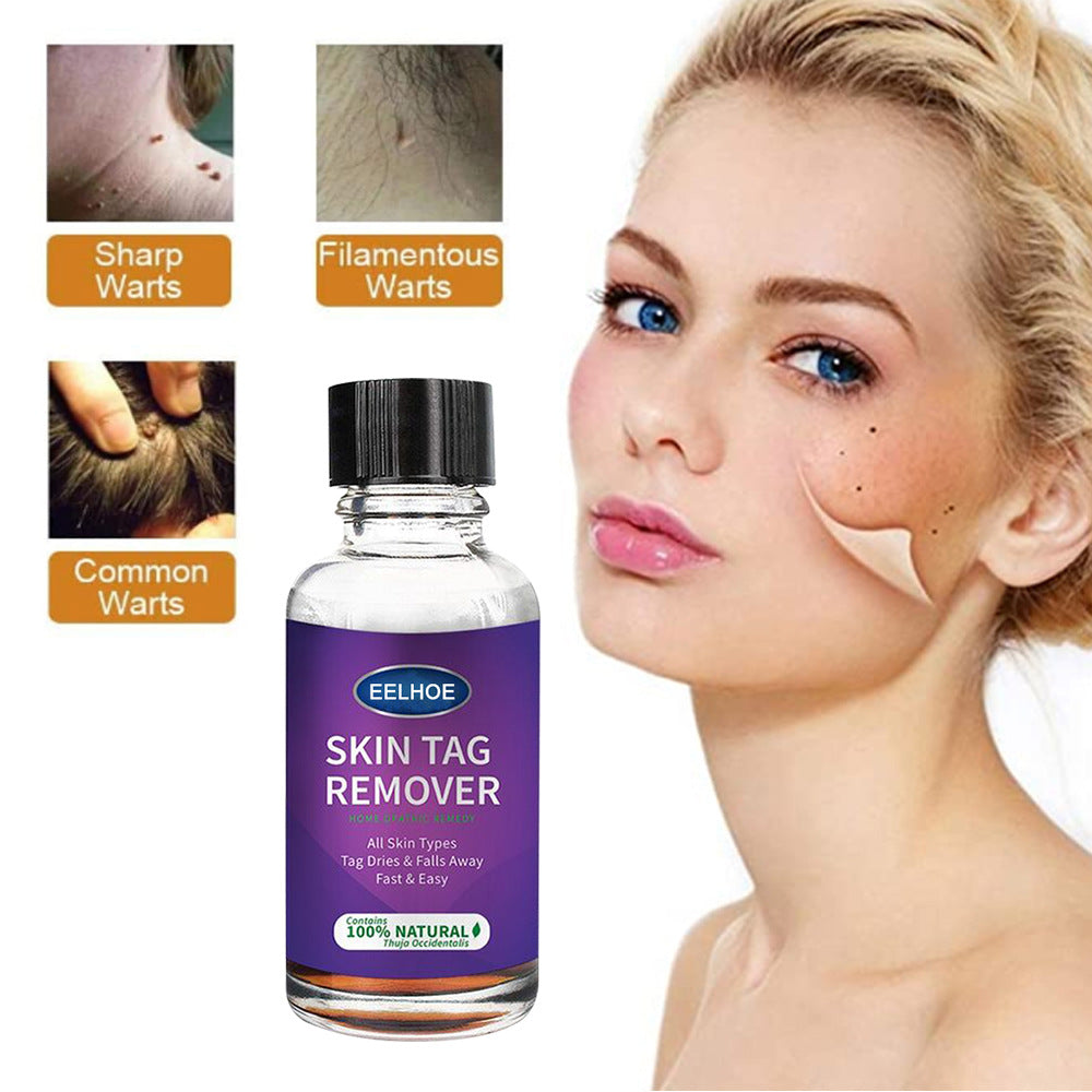 Foreign Trade Cross-Border Eelhoe Skin Verrucous Remover To Solve Skin Verrucous