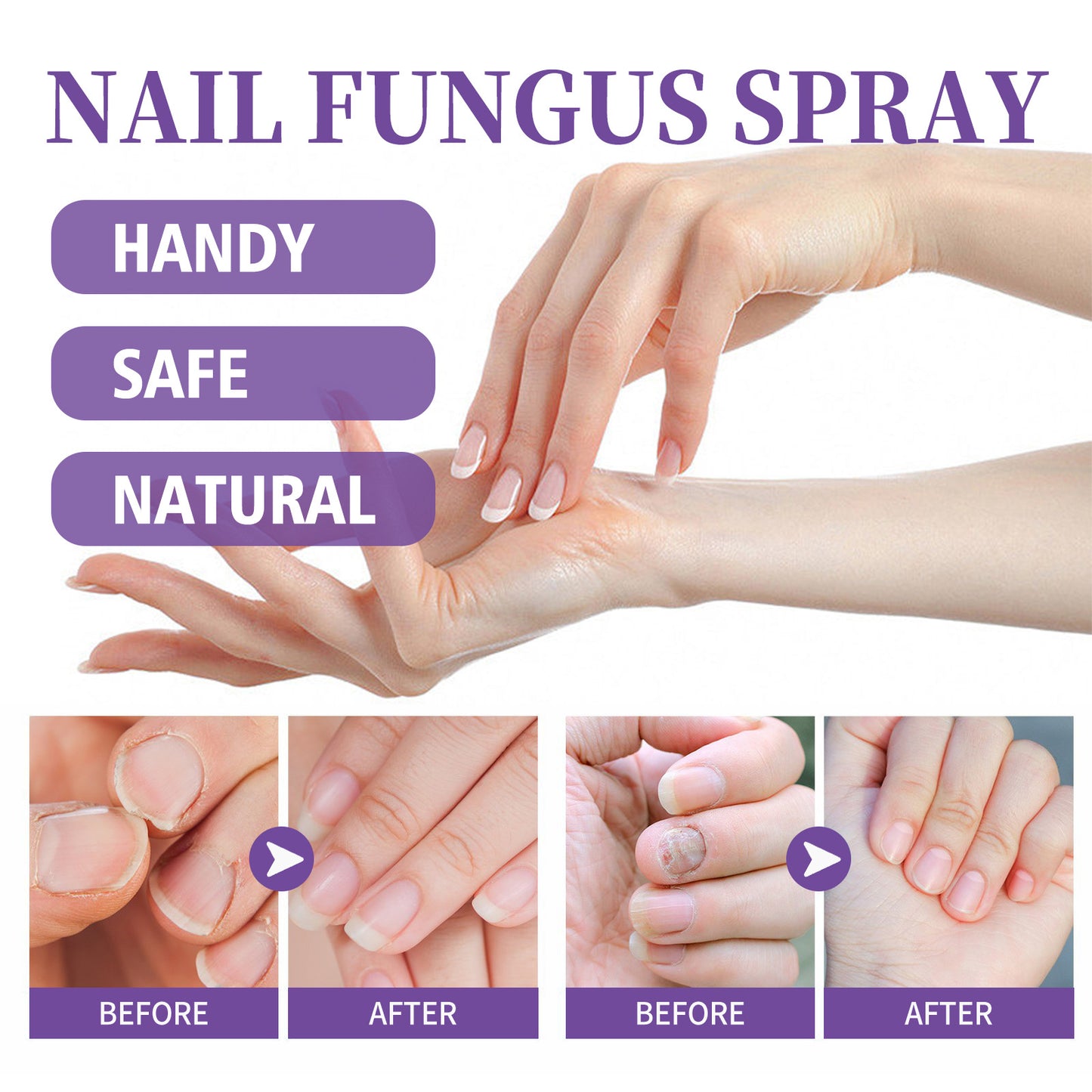 Nail Repair Spray Cleaning Care